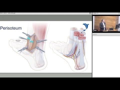 Posterior Malleolar Fractures in 2022 - Royal College of Physicians and Surgeons Glasgow 2022