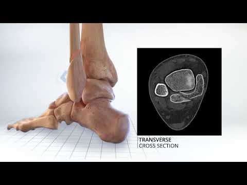 Hunterian Lecture 2020 - Posterior Malleolar Fractures - Lyndon Mason - BOA