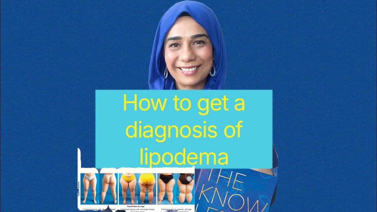 How to get a diagnosis of Lipodema