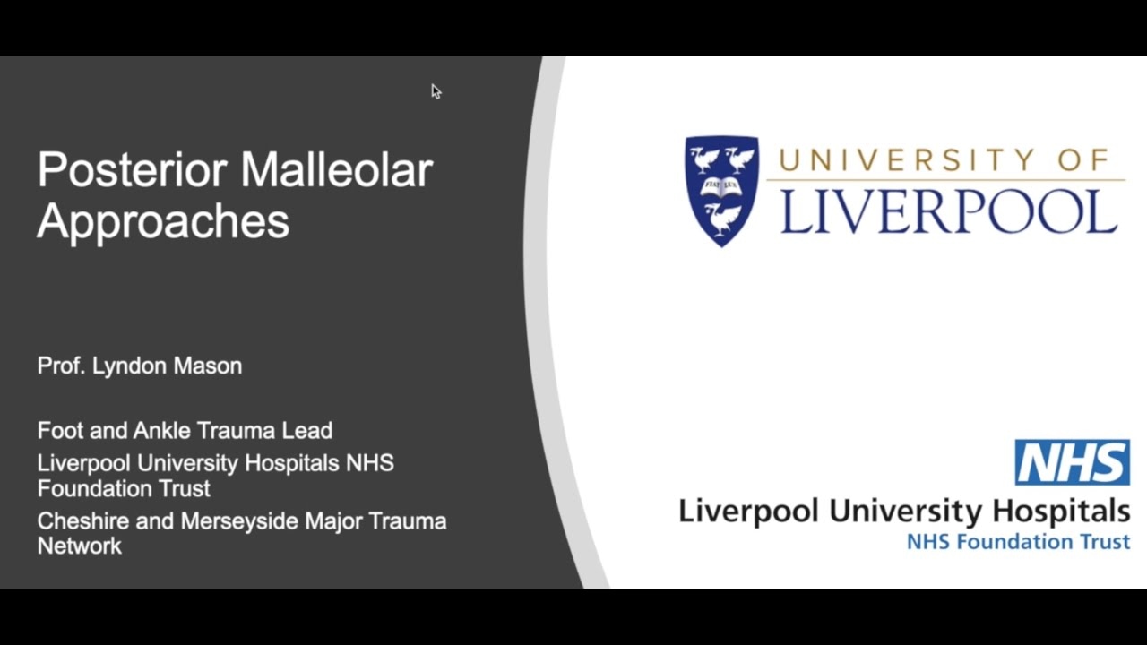 Posterior Malleolar Approaches